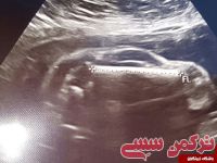 ادامه مطلب...
